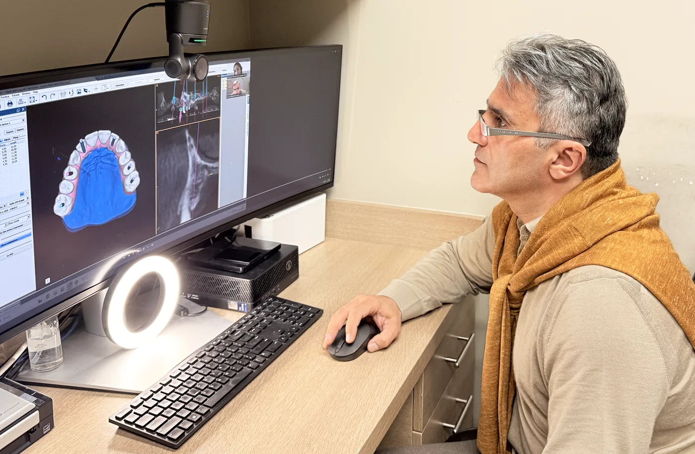 Collaboration and collective intelligence with DSD Planning Center (Madrid) for full-arch implant planning at Viva Smile, Granada Hills.